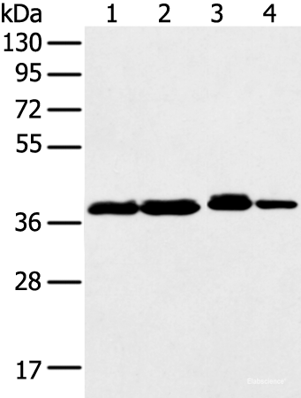Western blot analysis of 293T K562 Jurkat cell  using DCX Polyclonal Antibody at dilution of 1:500