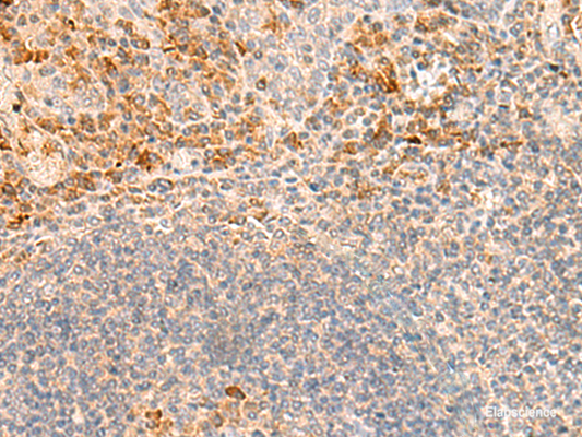 Immunohistochemistry of paraffin-embedded Human tonsil tissue  using GRM2 Polyclonal Antibody at dilution of 1:35(×200)