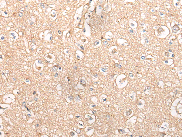 Immunohistochemistry of paraffin-embedded Human brain tissue  using MTNR1B Polyclonal Antibody at dilution of 1:55(×200)