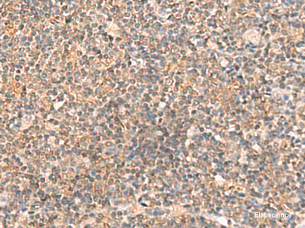 Immunohistochemistry of paraffin-embedded Human tonsil tissue  using ABCB4 Polyclonal Antibody at dilution of 1:40(×200)
