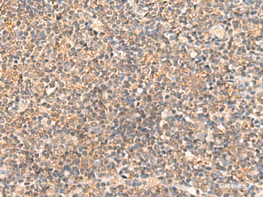 Immunohistochemistry of paraffin-embedded Human tonsil tissue  using ABCB4 Polyclonal Antibody at dilution of 1:40(×200)