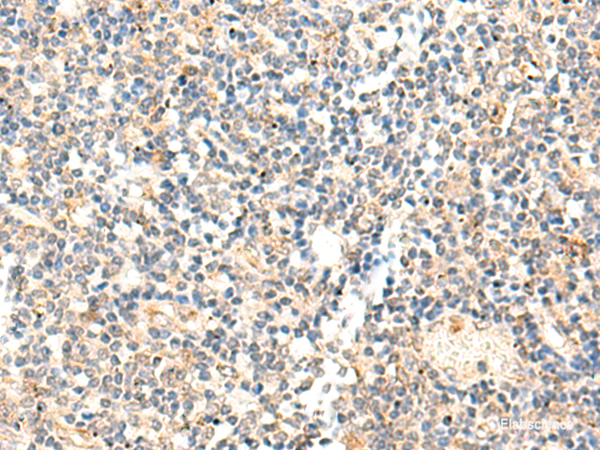 Immunohistochemistry of paraffin-embedded Human tonsil tissue  using ADAMTS2 Polyclonal Antibody at dilution of 1:40(×200)
