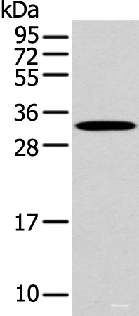 Western blot analysis of Mouse muscle tissue  using NANOS1 Polyclonal Antibody at dilution of 1:500