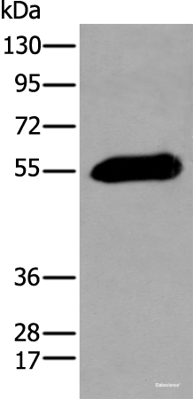 Western blot analysis of Human pancreas tissue  using GPC4 Polyclonal Antibody at dilution of 1:200