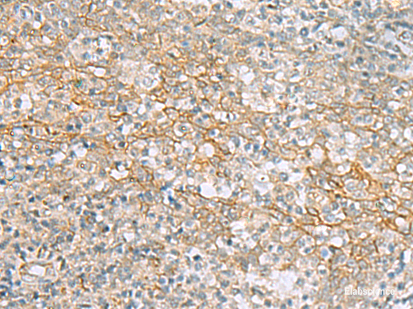Immunohistochemistry of paraffin-embedded Human tonsil tissue  using KCNH7 Polyclonal Antibody at dilution of 1:60(×200)