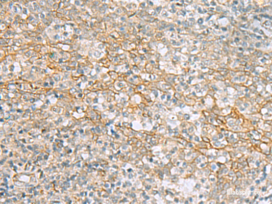 Immunohistochemistry of paraffin-embedded Human tonsil tissue  using KCNH7 Polyclonal Antibody at dilution of 1:60(×200)