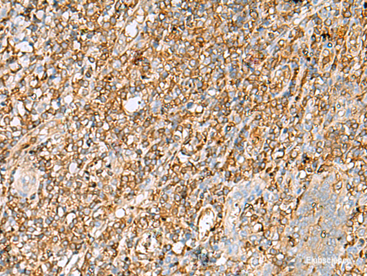 Immunohistochemistry of paraffin-embedded Human tonsil tissue  using LGALS9 Polyclonal Antibody at dilution of 1:30(×200)