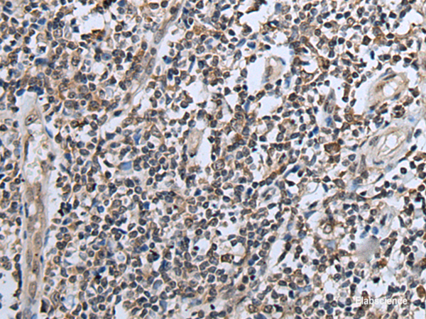 Immunohistochemistry of paraffin-embedded Human tonsil tissue  using CXCL6 Polyclonal Antibody at dilution of 1:60(×200)