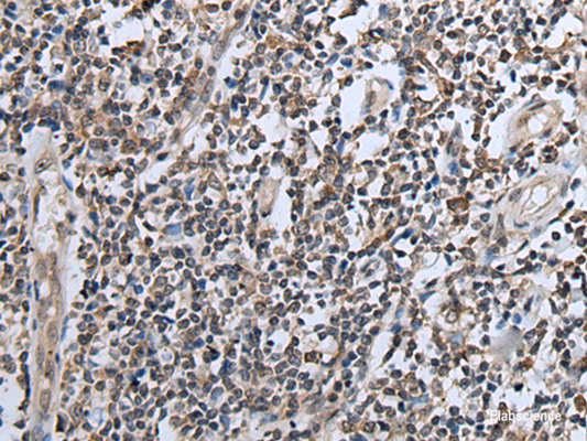 Immunohistochemistry of paraffin-embedded Human tonsil tissue  using CXCL6 Polyclonal Antibody at dilution of 1:60(×200)
