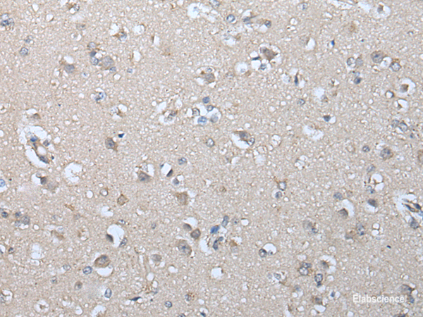 Immunohistochemistry of paraffin-embedded Human brain tissue  using IFNB1 Polyclonal Antibody at dilution of 1:45(×200)