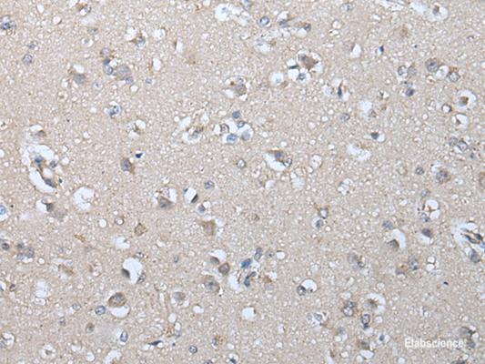 Immunohistochemistry of paraffin-embedded Human brain tissue  using IFNB1 Polyclonal Antibody at dilution of 1:45(×200)