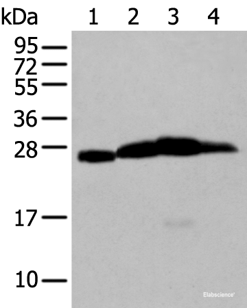 Western blot analysis of Mouse brain tissue Rat brain tissue Human cerebrum tissue Human cerebella tissue lysates  using MOG Polyclonal Antibody at dilution of 1:250