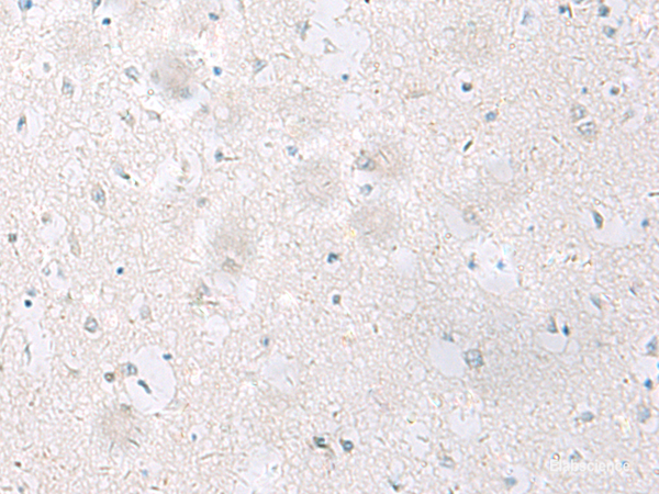 Immunohistochemistry of paraffin-embedded Human brain tissue  using SST Polyclonal Antibody at dilution of 1:60(×200)