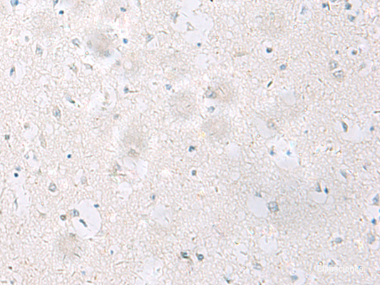 Immunohistochemistry of paraffin-embedded Human brain tissue  using SST Polyclonal Antibody at dilution of 1:60(×200)