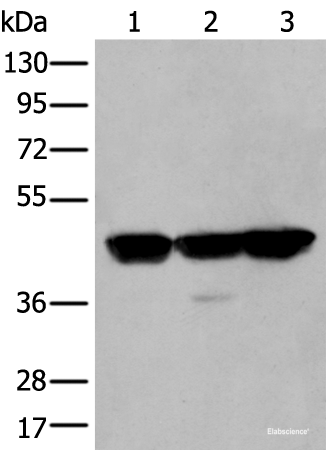 Western blot analysis of Hela A431 and Hepg2 cell lysates  using PLAG1 Polyclonal Antibody at dilution of 1:200
