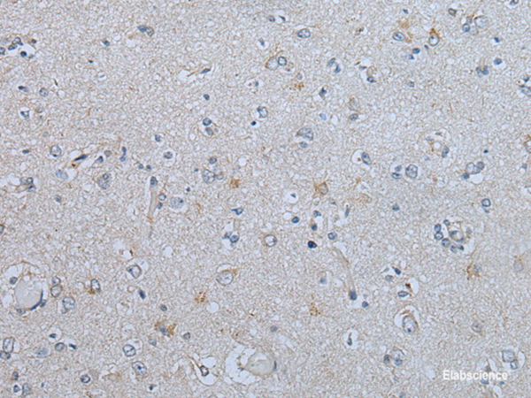 Immunohistochemistry of paraffin-embedded Human brain tissue  using CENPF Polyclonal Antibody at dilution of 1:60(×200)