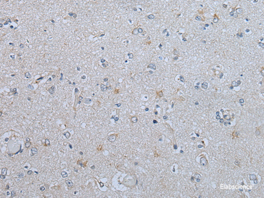 Immunohistochemistry of paraffin-embedded Human brain tissue  using CENPF Polyclonal Antibody at dilution of 1:60(×200)