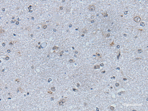 Immunohistochemistry of paraffin-embedded Human brain tissue  using EFNB1 Polyclonal Antibody at dilution of 1:50(×200)