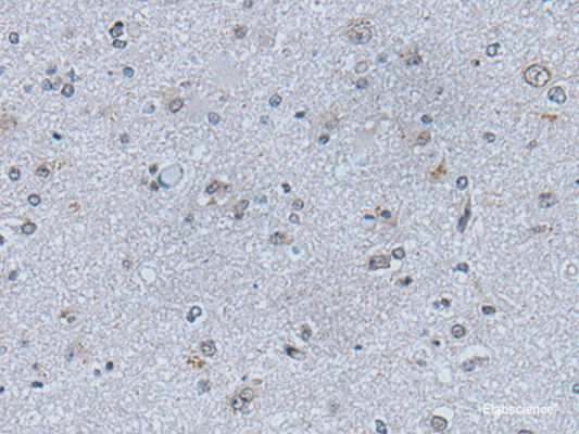 Immunohistochemistry of paraffin-embedded Human brain tissue  using EFNB1 Polyclonal Antibody at dilution of 1:50(×200)