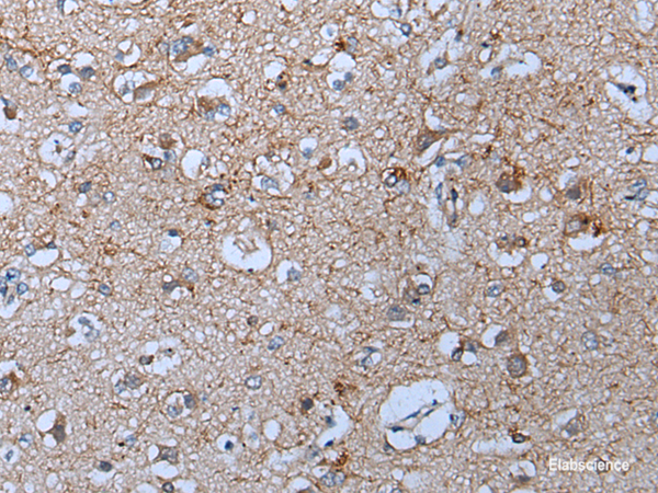 Immunohistochemistry of paraffin-embedded Human brain tissue  using YPEL5 Polyclonal Antibody at dilution of 1:60(×200)