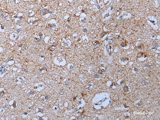 Immunohistochemistry of paraffin-embedded Human brain tissue  using YPEL5 Polyclonal Antibody at dilution of 1:60(×200)