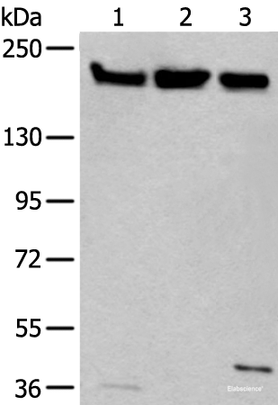 Western blot analysis of Hela 231 and K562 cell lysates  using XRN1 Polyclonal Antibody at dilution of 1:250