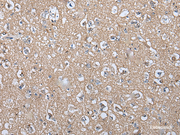 Immunohistochemistry of paraffin-embedded Human brain tissue  using WIF1 Polyclonal Antibody at dilution of 1:100(×200)