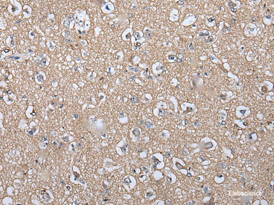 Immunohistochemistry of paraffin-embedded Human brain tissue  using WIF1 Polyclonal Antibody at dilution of 1:100(×200)
