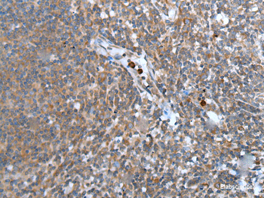 Immunohistochemistry of paraffin-embedded Human tonsil tissue  using WISP2 Polyclonal Antibody at dilution of 1:45(×200)