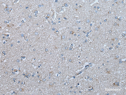 Immunohistochemistry of paraffin-embedded Human brain tissue  using UBR4 Polyclonal Antibody at dilution of 1:65(×200)