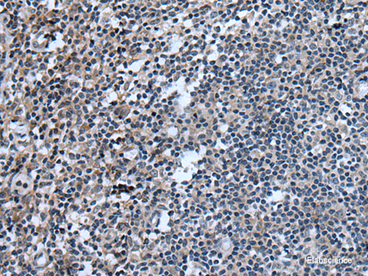 Immunohistochemistry of paraffin-embedded Human tonsil tissue  using UGT8 Polyclonal Antibody at dilution of 1:55(×200)