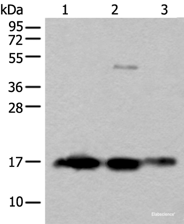 Western blot analysis of Rat brain tissue Human cerebrum tissue Human cerebella tissue lysates  using SNCB Polyclonal Antibody at dilution of 1:450
