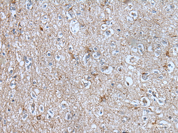Immunohistochemistry of paraffin-embedded Human brain tissue  using BMP1 Polyclonal Antibody at dilution of 1:105(×200)