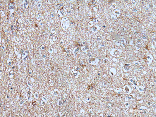 Immunohistochemistry of paraffin-embedded Human brain tissue  using BMP1 Polyclonal Antibody at dilution of 1:105(×200)
