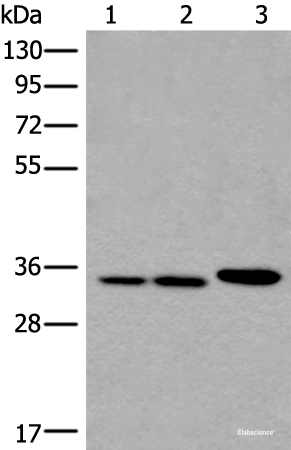 Western blot analysis of A549 Hela and K562 cell lysates  using RPF2 Polyclonal Antibody at dilution of 1:400