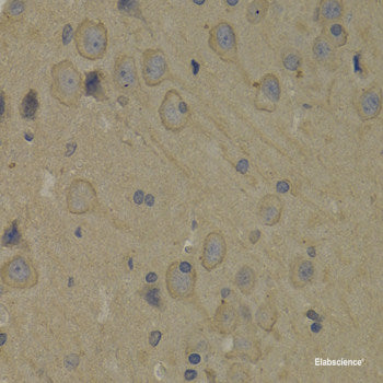 Immunofluorescence analysis of C6 cells using MYOD1 Polyclonal Antibody at dilution of  1:100. Blue: DAPI for nuclear staining.