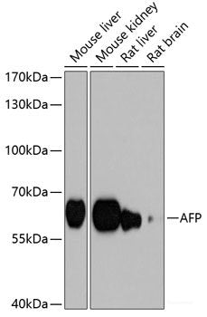 Immunohistochemistry of paraffin-embedded Rat pancreatic islet using TSC1 Polyclonal Antibody at dilution of  1:200 (40x lens).