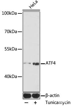 Immunohistochemistry of paraffin-embedded Human prostate using CBL Polyclonal Antibody at dilution of  1:200 (40x lens).