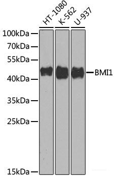Immunohistochemistry of paraffin-embedded Human appendix using CD34 Polyclonal Antibody at dilution of  1:100 (40x lens).