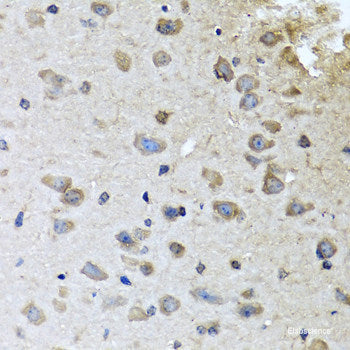 Immunohistochemistry of paraffin-embedded Rat heart using EIF2S1 Polyclonal Antibody at dilution of  1:100 (40x lens).