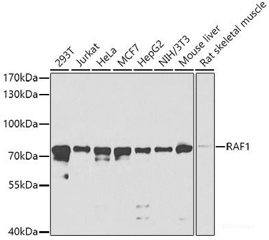 Immunohistochemistry of paraffin-embedded Rat ovary using PTCH1 Polyclonal Antibody at dilution of  1:100 (40x lens).