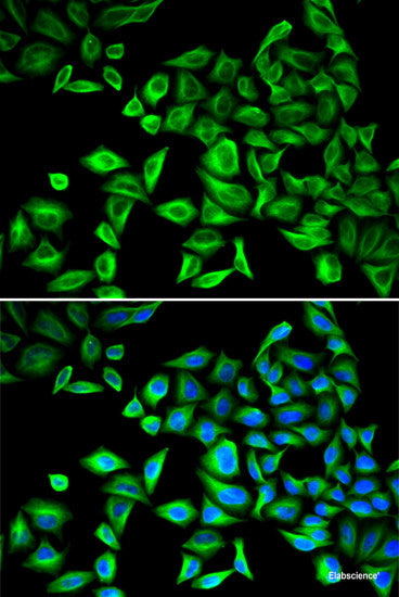 Immunofluorescence analysis of U2OS cells using BIRC3 Polyclonal Antibody at dilution of  1:100. Blue: DAPI for nuclear staining.