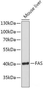 Immunohistochemistry of paraffin-embedded Human lung cancer using HDAC2 Polyclonal Antibody at dilution of  1:100 (40x lens).