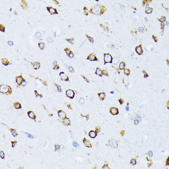 Immunohistochemistry of paraffin-embedded Rat ovary using CDK9 Polyclonal Antibody at dilution of  1:100 (40x lens).