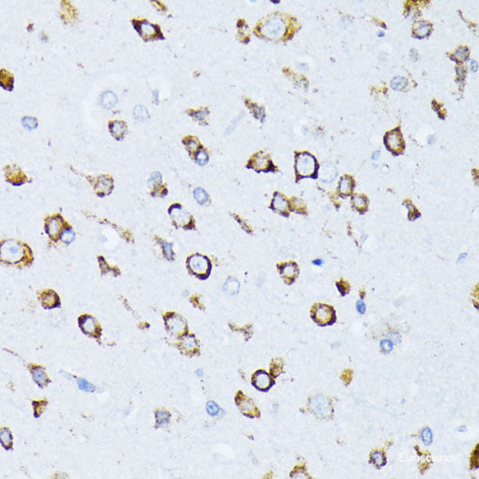Immunohistochemistry of paraffin-embedded Rat ovary using CDK9 Polyclonal Antibody at dilution of  1:100 (40x lens).