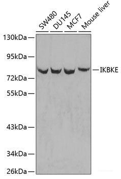Immunohistochemistry of paraffin-embedded Rat pancreas using SLC1A2 Polyclonal Antibody at dilution of  1:100 (40x lens).