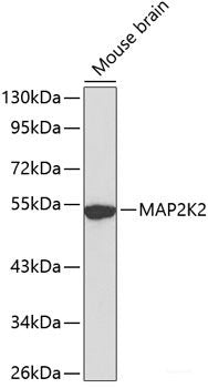 Immunohistochemistry of paraffin-embedded Rat kidney using FABP5 Polyclonal Antibody at dilution of  1:100 (40x lens).