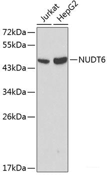 Immunohistochemistry of paraffin-embedded Human liver cancer using Caspase-1 Polyclonal Antibody at dilution of  1:100 (40x lens).
