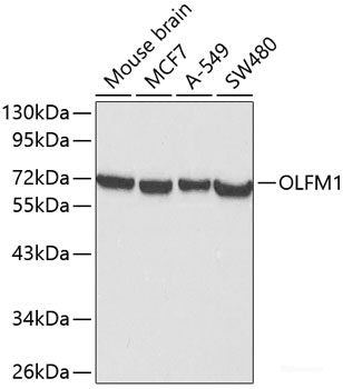 Immunohistochemistry of paraffin-embedded Human stomach using CTSB Polyclonal Antibody at dilution of  1:100 (40x lens).