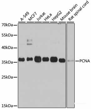 Immunohistochemistry of paraffin-embedded Rat brain using GAD2 Polyclonal Antibody at dilution of  1:100 (40x lens).